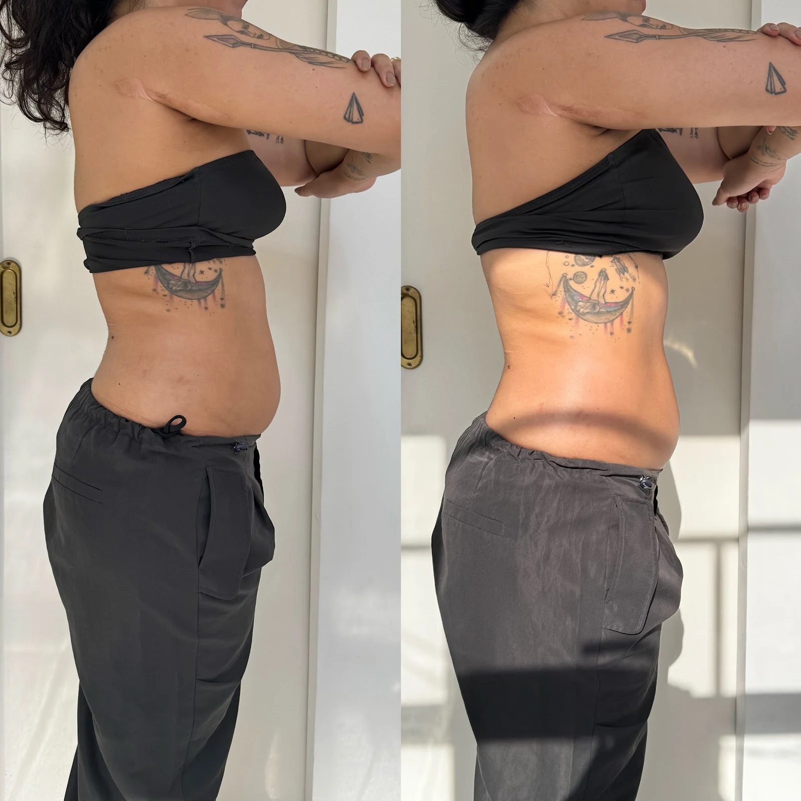 Antes e depois corporal, de perfil: à esquerda o abdômen com mais volume, à direita mais definido.